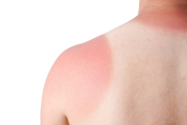 Why Not to Use Sunscreen? Expert Study Revealed 